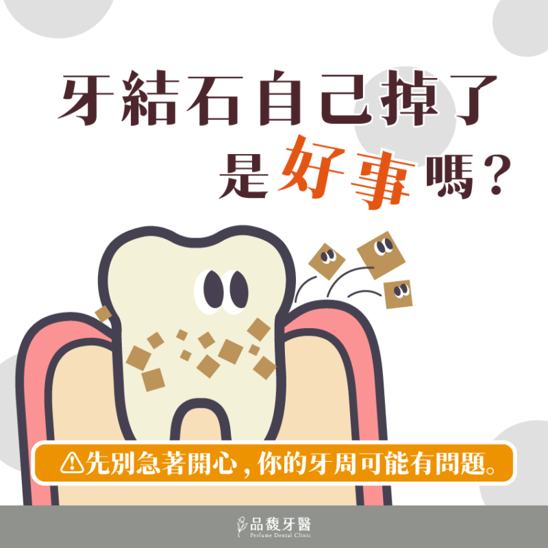 牙結石自己掉了是好事嗎？先別急著開心，可能代表牙周出問題