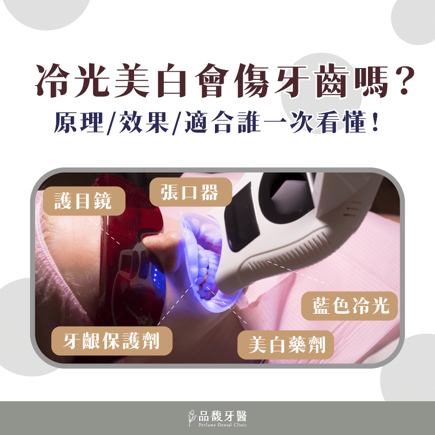 冷光美白會傷牙齒嗎？可以維持多久？原理、效果和適合對象一次看懂